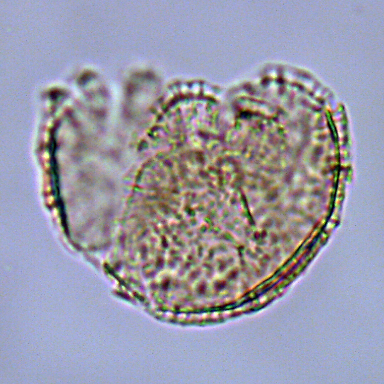 Elytrocysta druggii, U1581-19R-7W, 66-70, sl. 1, M29-1, foto-a.jpg